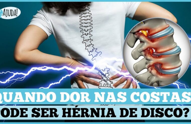 Hérnia de Disco na Coluna: Causas, Sintomas e Tratamentos 🌟