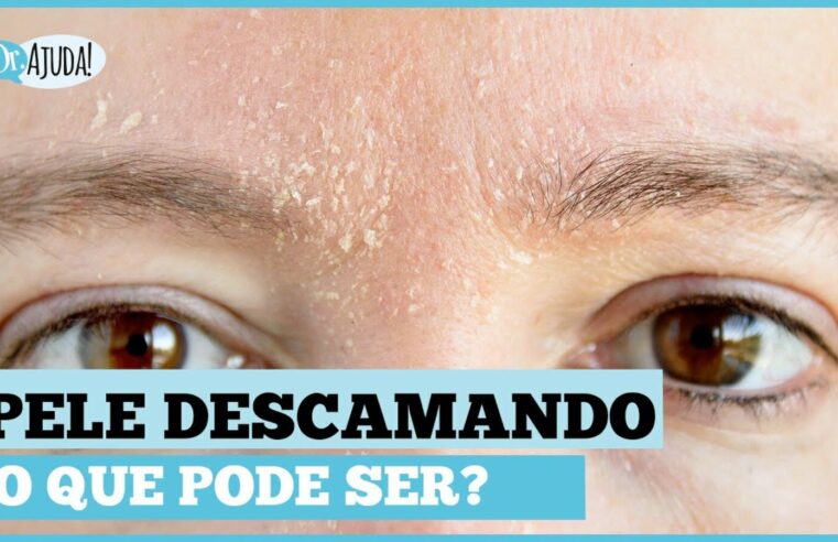 Descamação da Pele: Causas, Sintomas e Como Tratar 🌿🔍