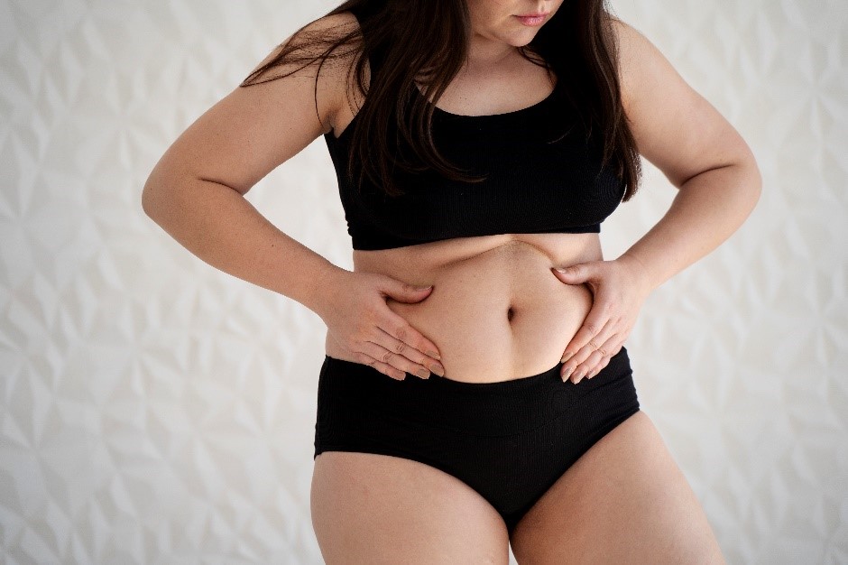 Descubra 5 Sinais de Intestino Inflamado na Saúde da Mulher! 🌿💪