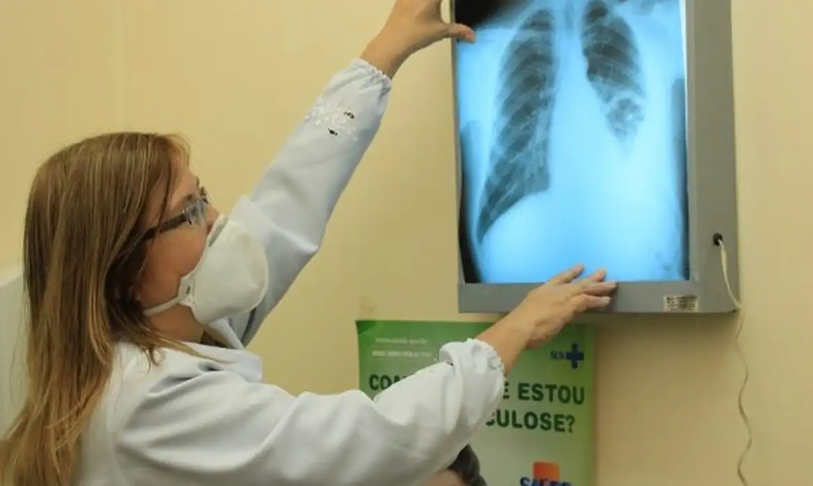 🦠 Tuberculose no Brasil: Desafios e Mitos Desmistificados pela Saúde Pública 🌍