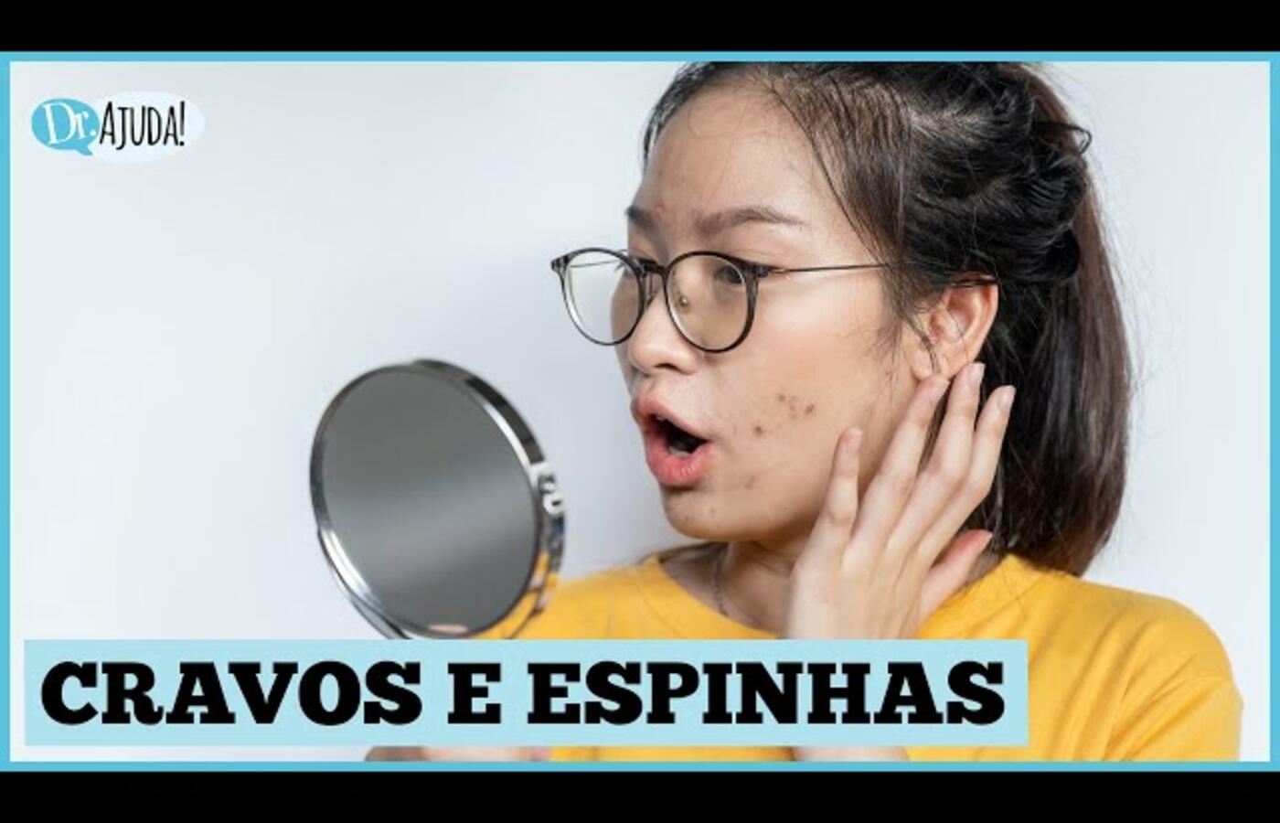 Cravos: Como Tratar e Prevenir com Dicas de Especialista! 🌟🧴