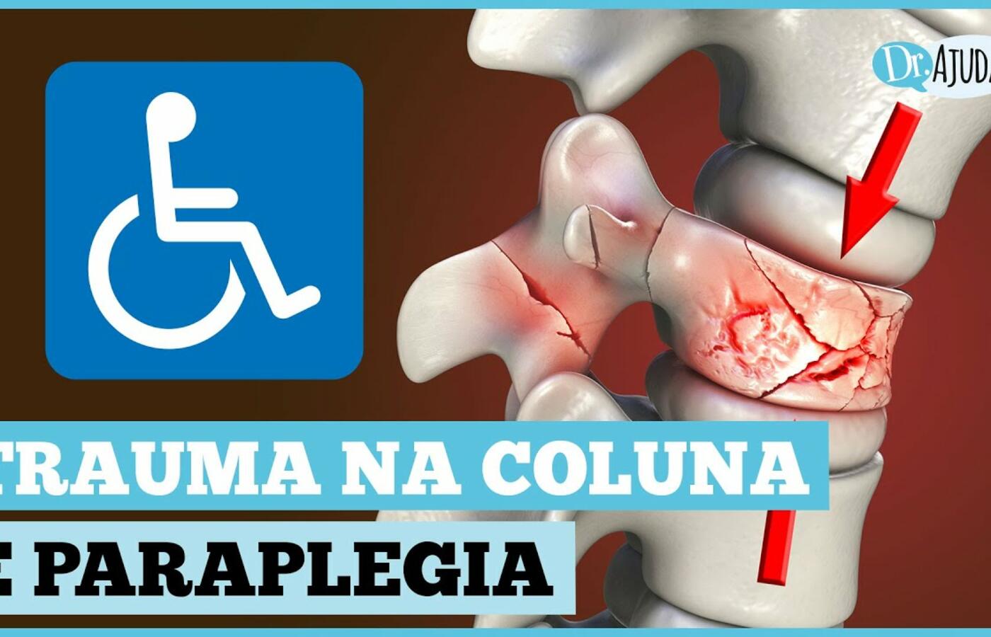 Trauma raquimedular: como identificar e agir rapidamente