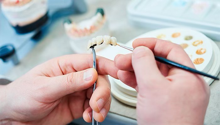 Transforme seu sorriso com o atendimento de próteses dentárias