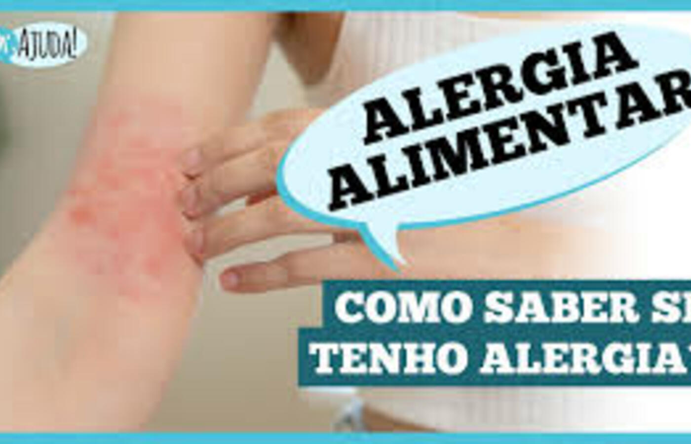 Entenda os Sintomas da Alergia Alimentar e Como Agir