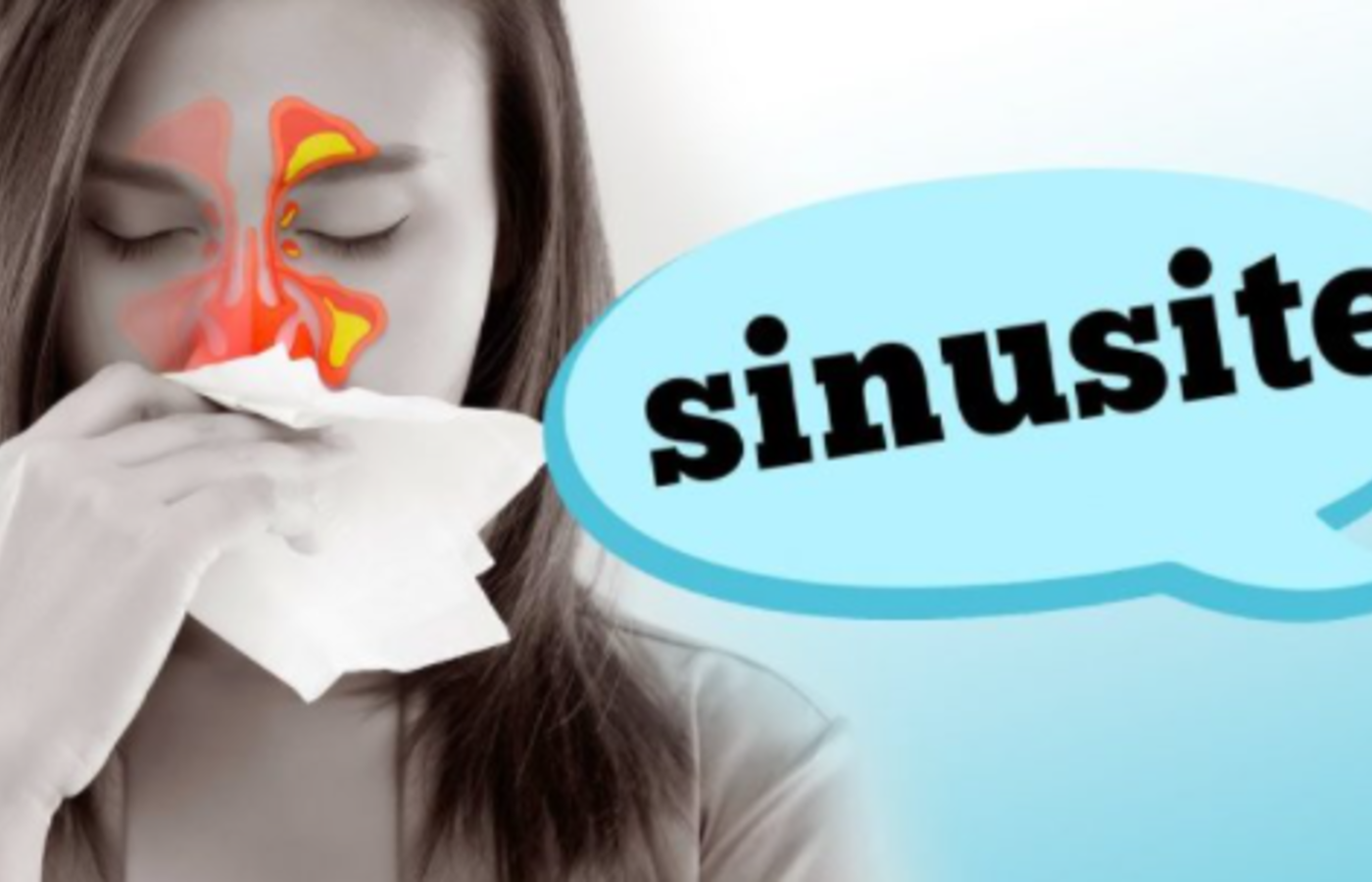 Sinusite: Sintomas e Dicas da Especialista para Alívio Rápido