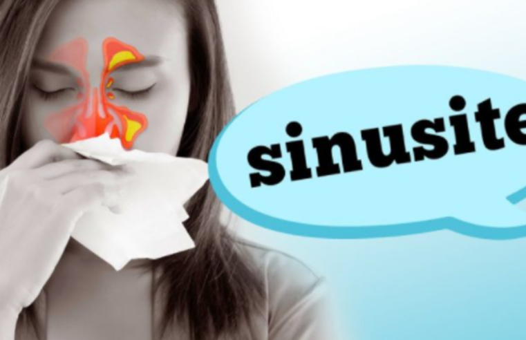 Sinusite: Sintomas e Dicas da Especialista para Alívio Rápido