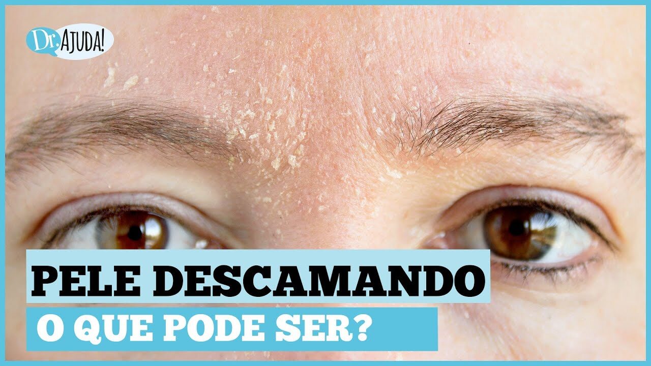 Descamação Da Pele: Causas, Sintomas E Como Tratar 🌿🔍 - Portal Blog Do Lago